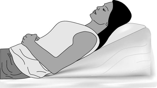 La migliore posizione per dormire per ridurre il reflusso acido